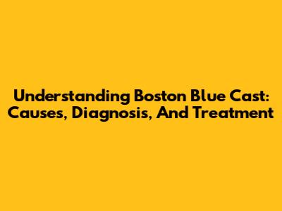 Understanding Boston Blue Cast: Causes, Diagnosis, And Treatment